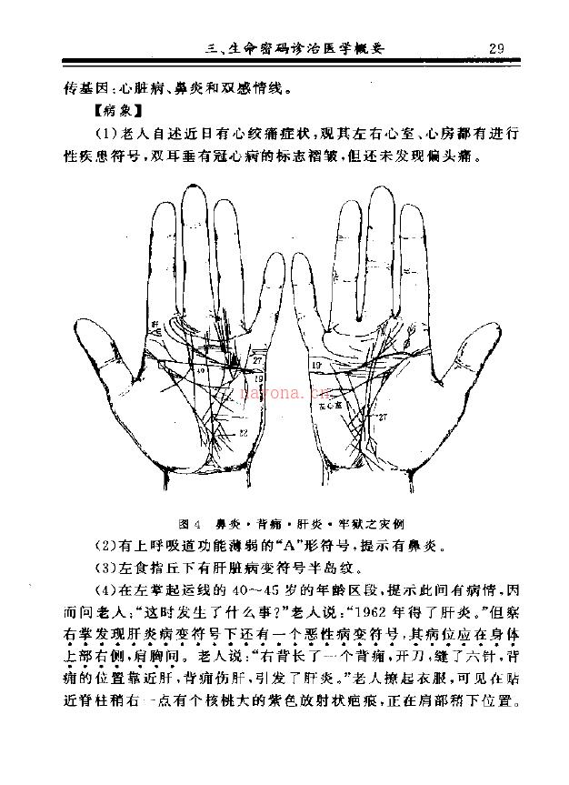 王大有 掌纹诊病实用图谱.pdf 下载 百度网盘资源