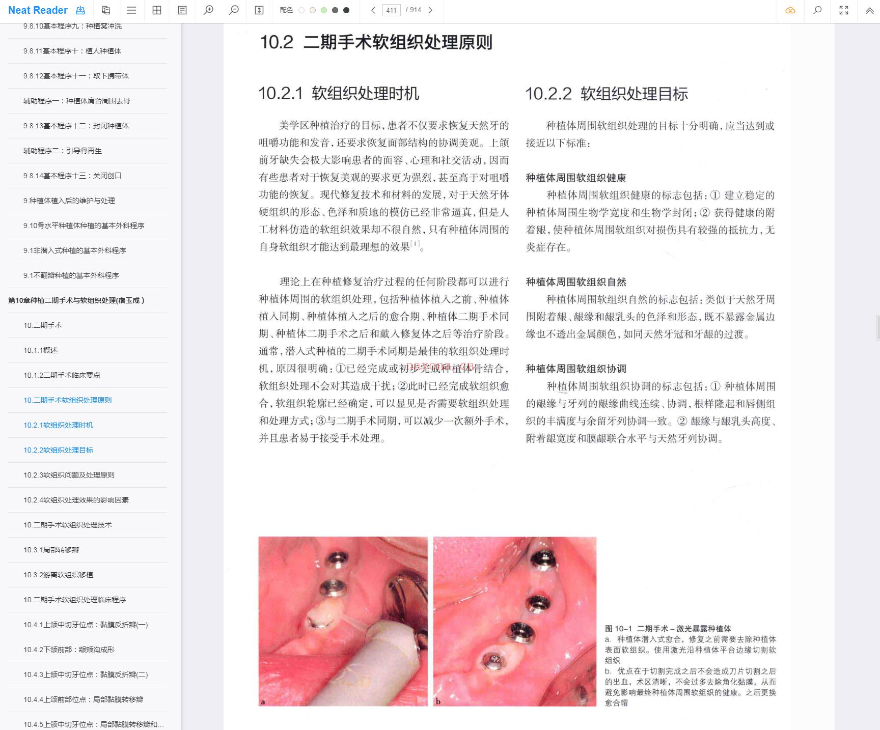 《口腔种植学（第2版）》截图（点击放大）