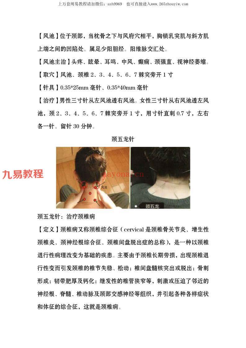 百家针法pdf 107页 百度云下载！