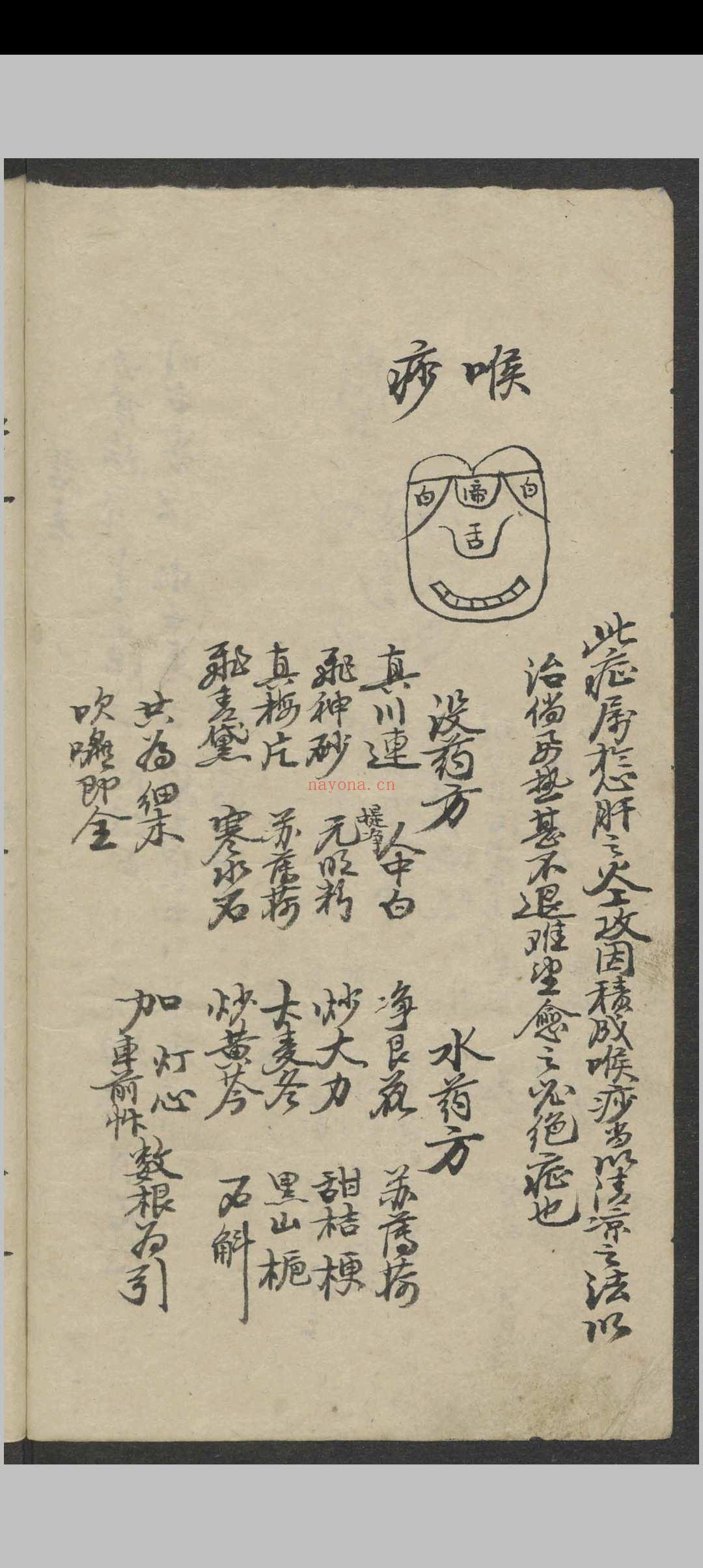 郑宏绩 秘传喉科   1900