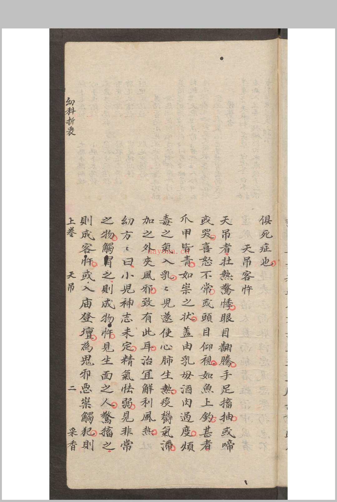 秦昌遇  顾廷瑞  幼科折衷 2卷 (存卷1) , 1875