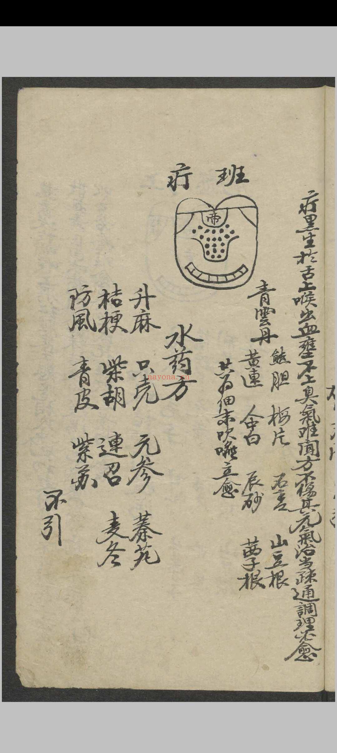 郑宏绩 秘传喉科   1900