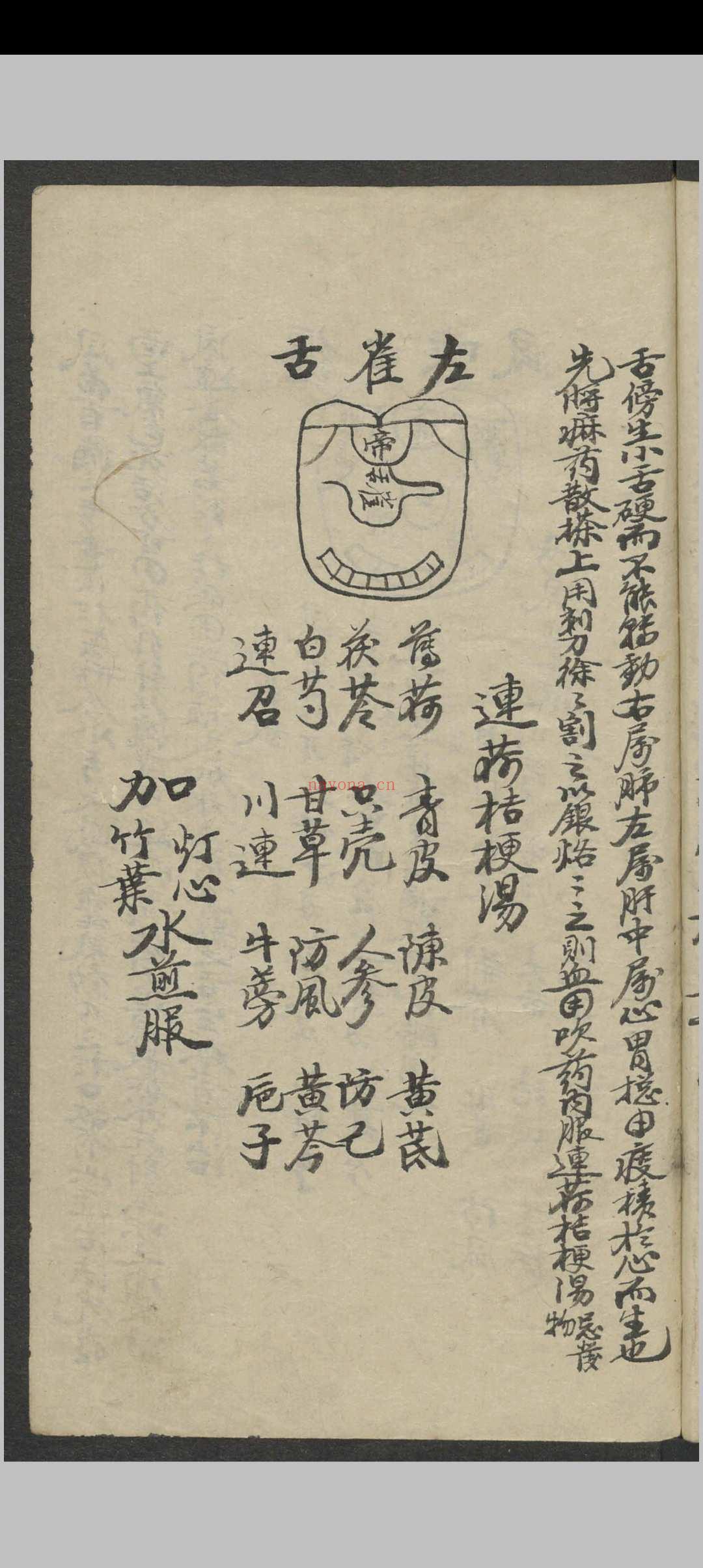 郑宏绩 秘传喉科   1900