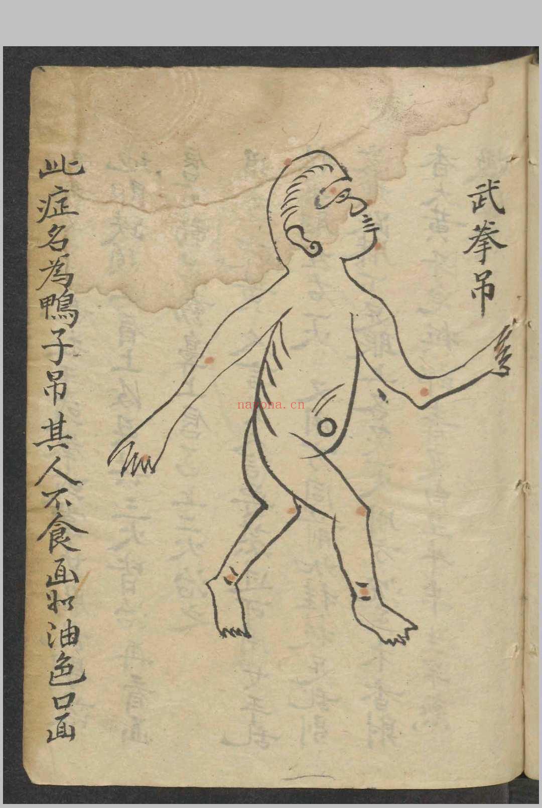 男妇诸吊便方   1900