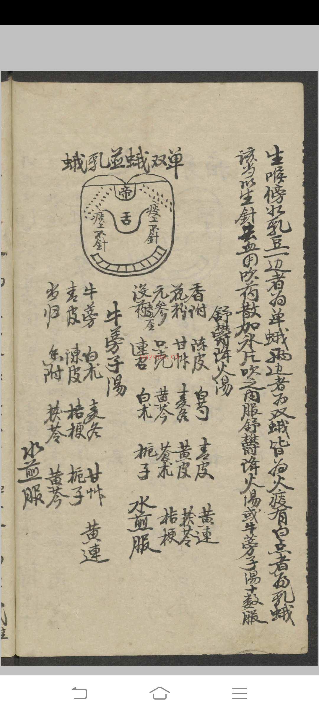 郑宏绩 秘传喉科   1900