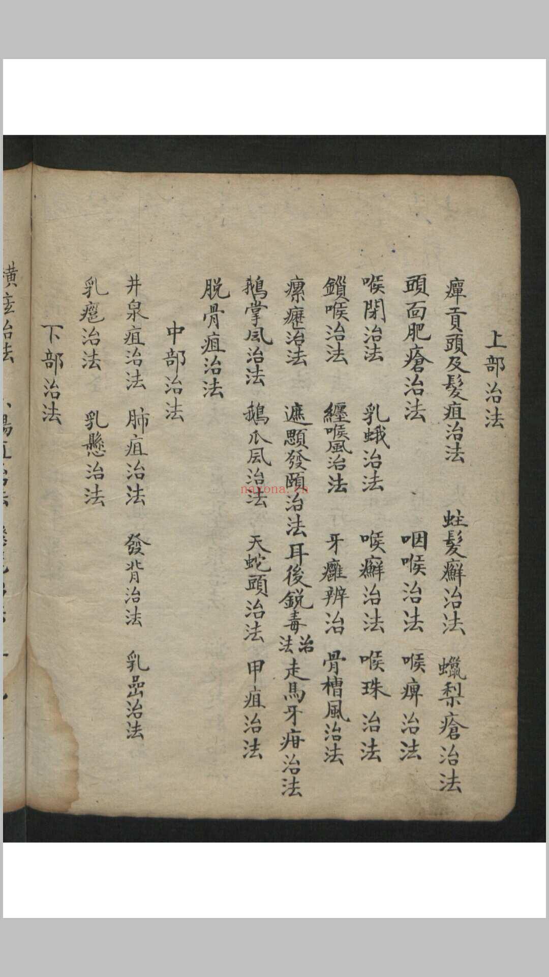 王维德 罗湖 外科证治全生集 , 1886