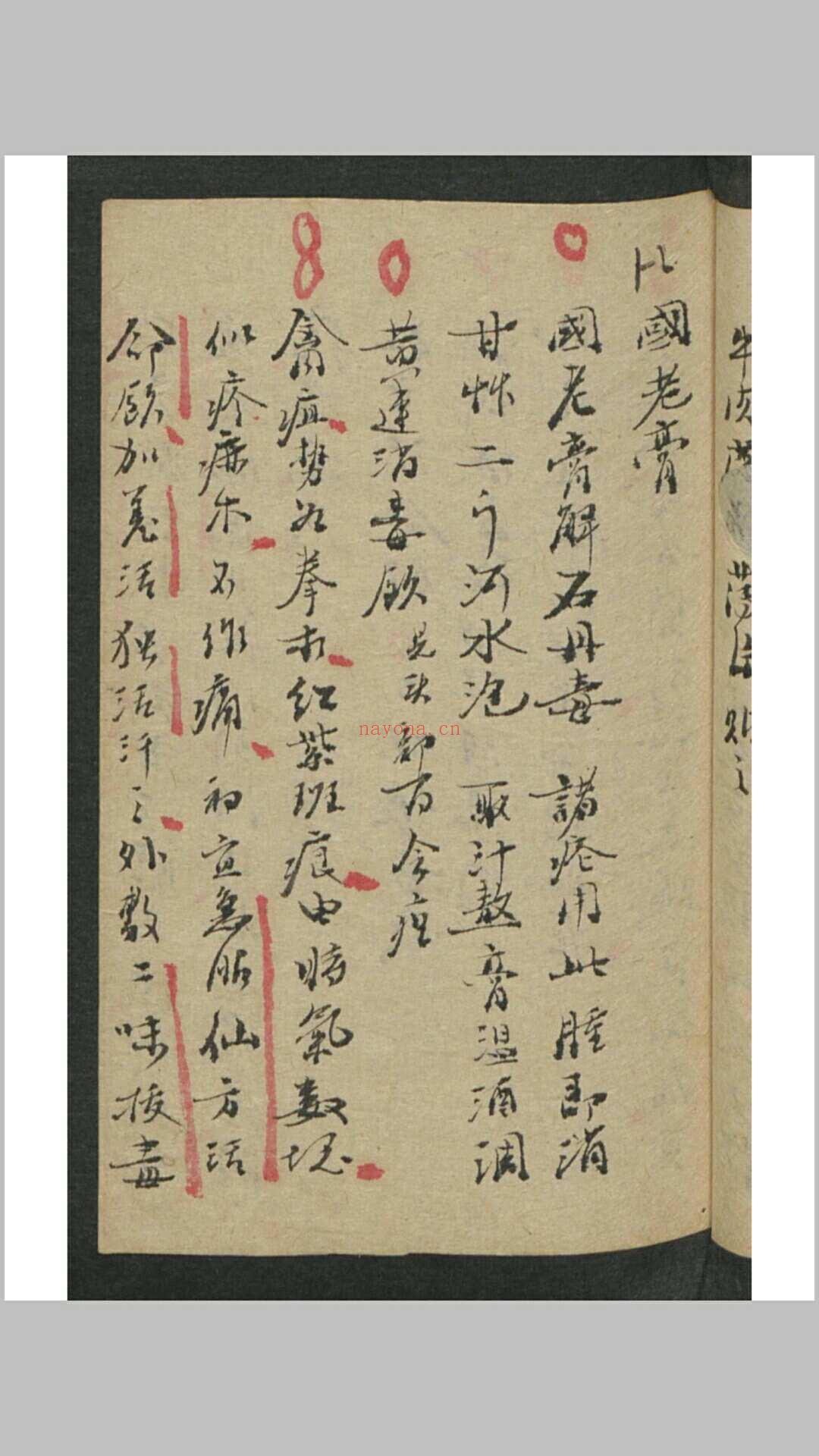 吴谦 外科金鉴 , 1913