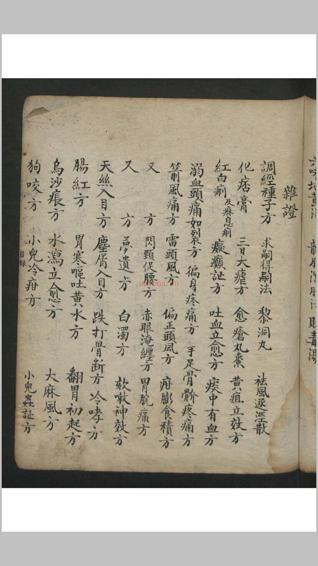 王维德 罗湖 外科证治全生集 , 1886