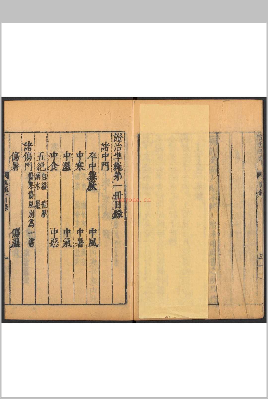 证治准绳. 六种 四四卷 王肯堂撰 明万历三十至三六年(1602-1608) 王肯堂刊.重修本.清初