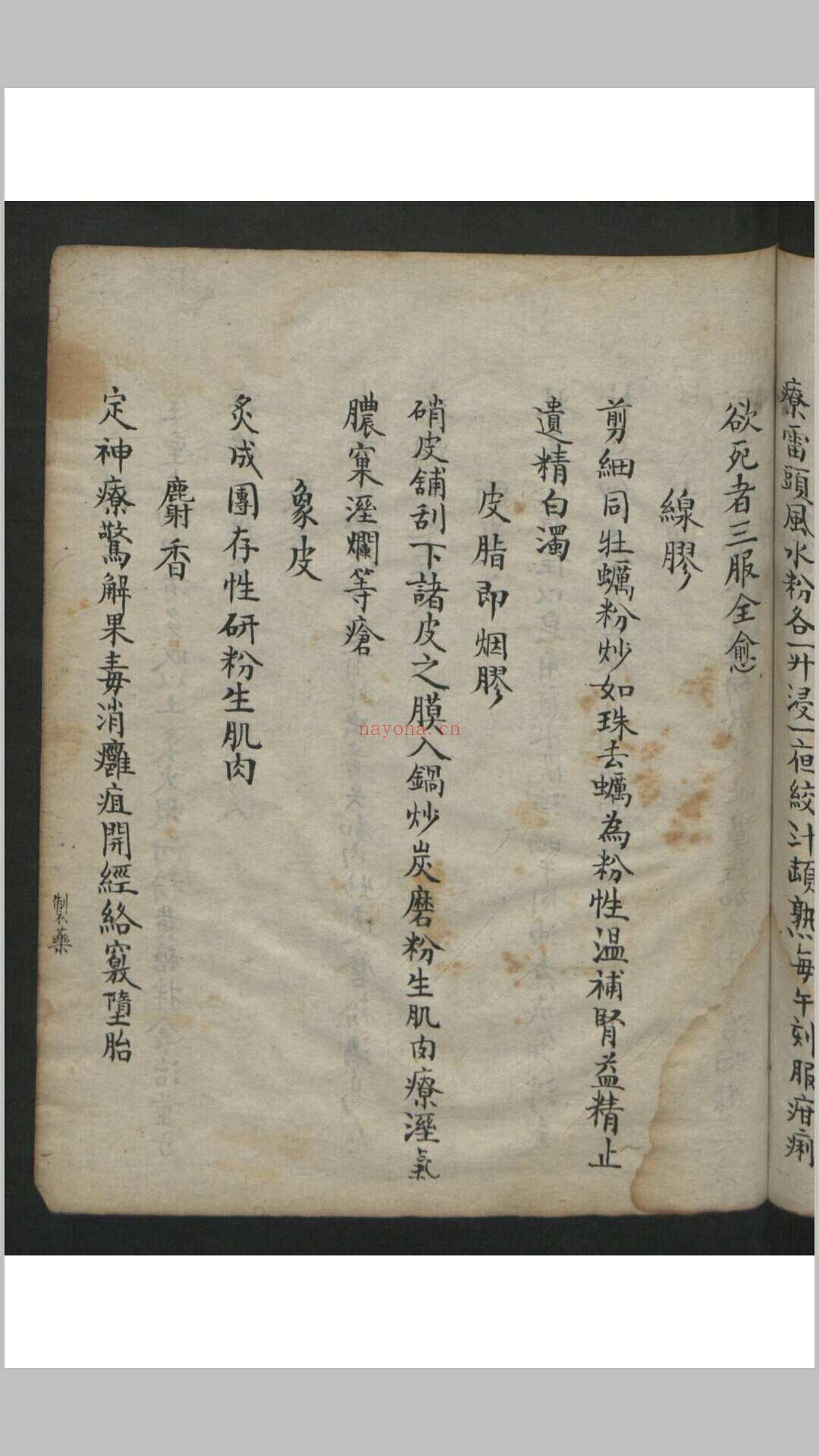 王维德 罗湖 外科证治全生集 , 1886