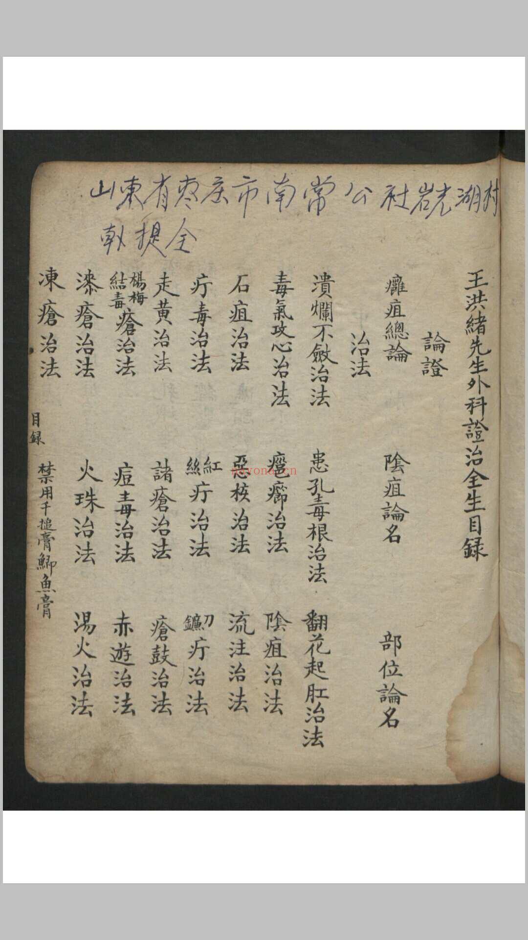 王维德 罗湖 外科证治全生集 , 1886