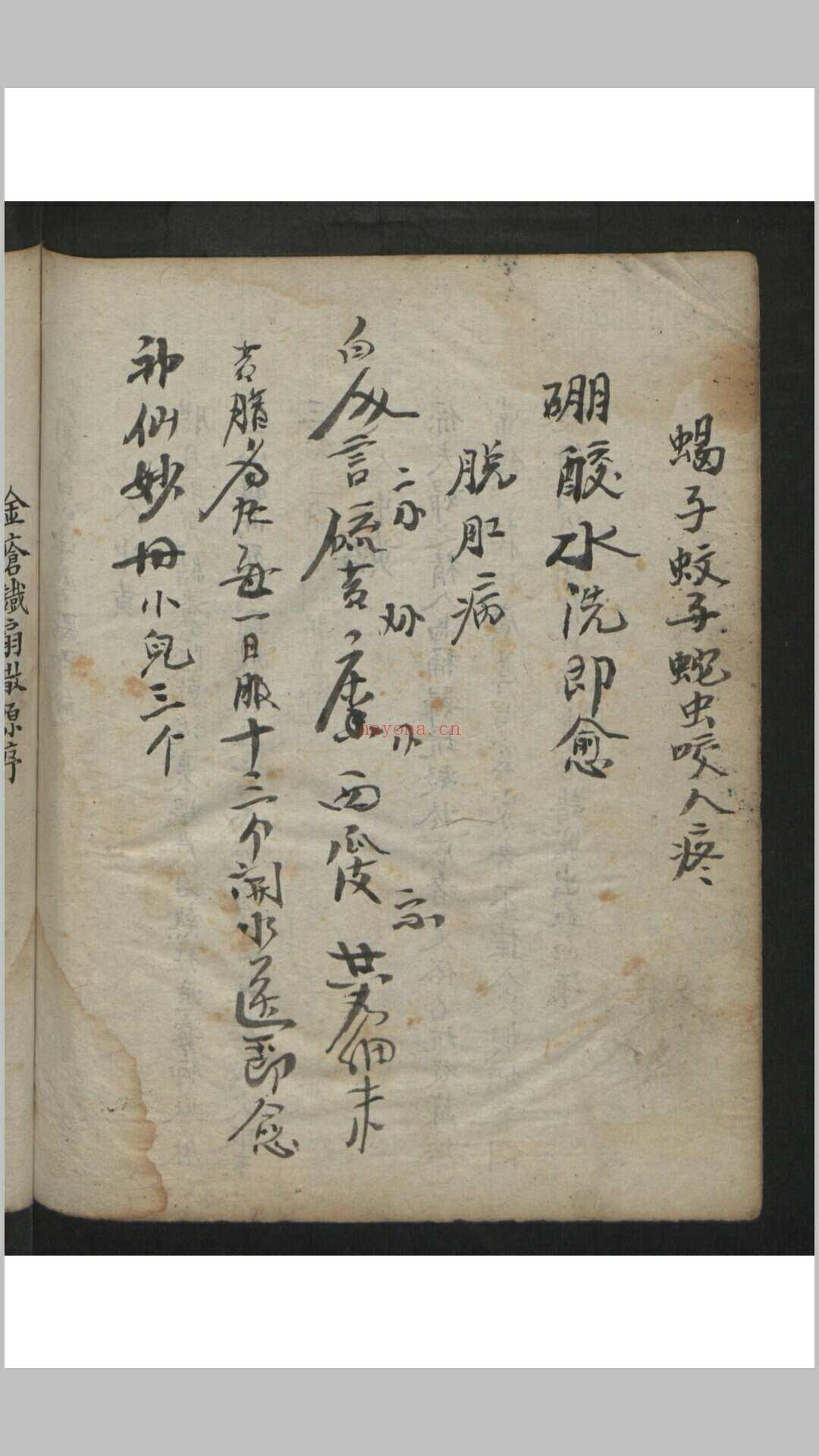 王维德 罗湖 外科证治全生集 , 1886