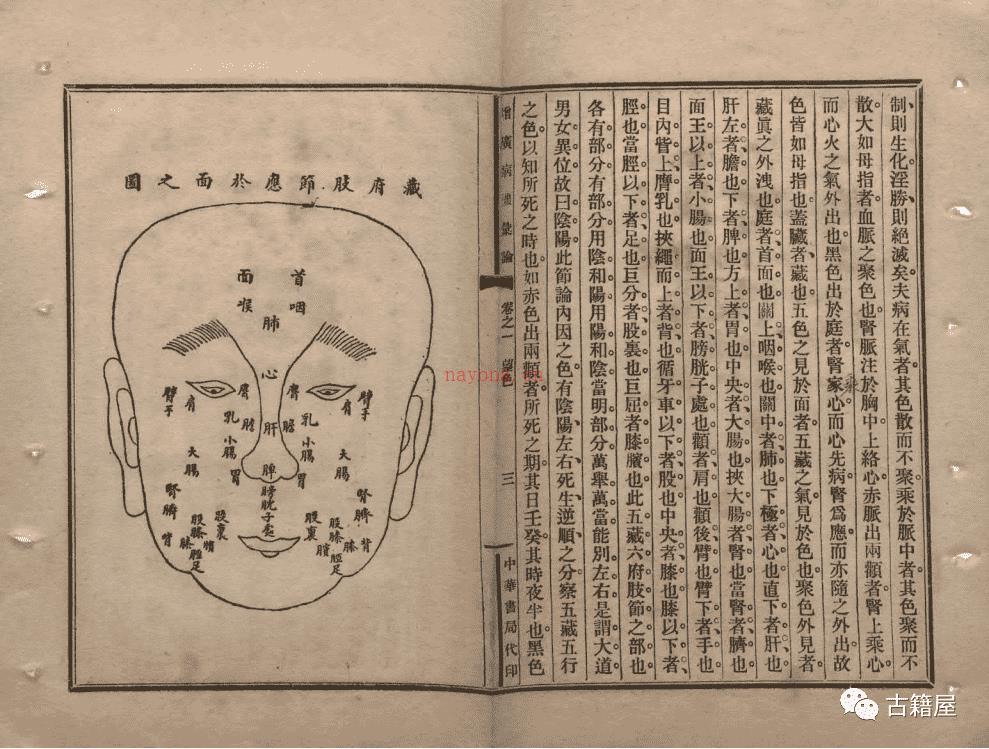 中医内科古籍《增广病机汇论》