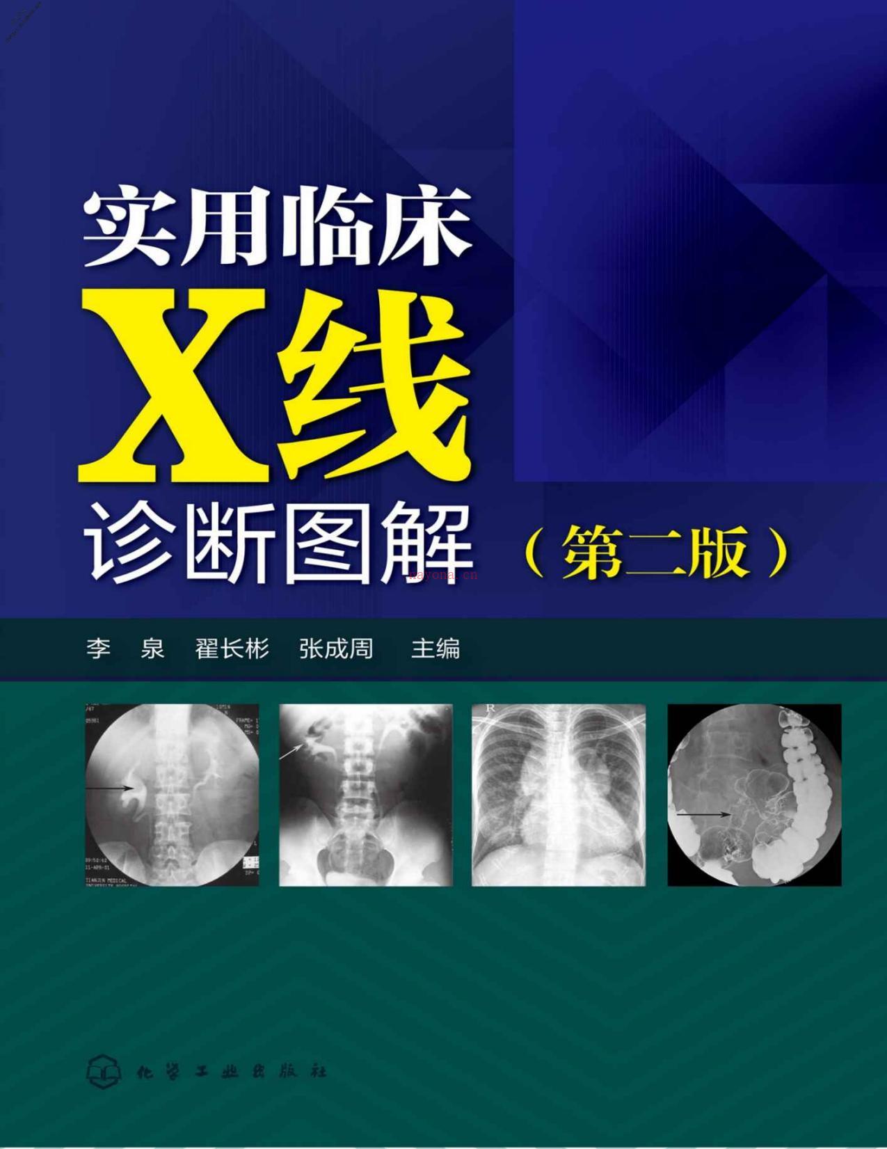 实用临床X线诊断图解(第二版)-李泉&翟长彬&张成周 PDF电子版下载