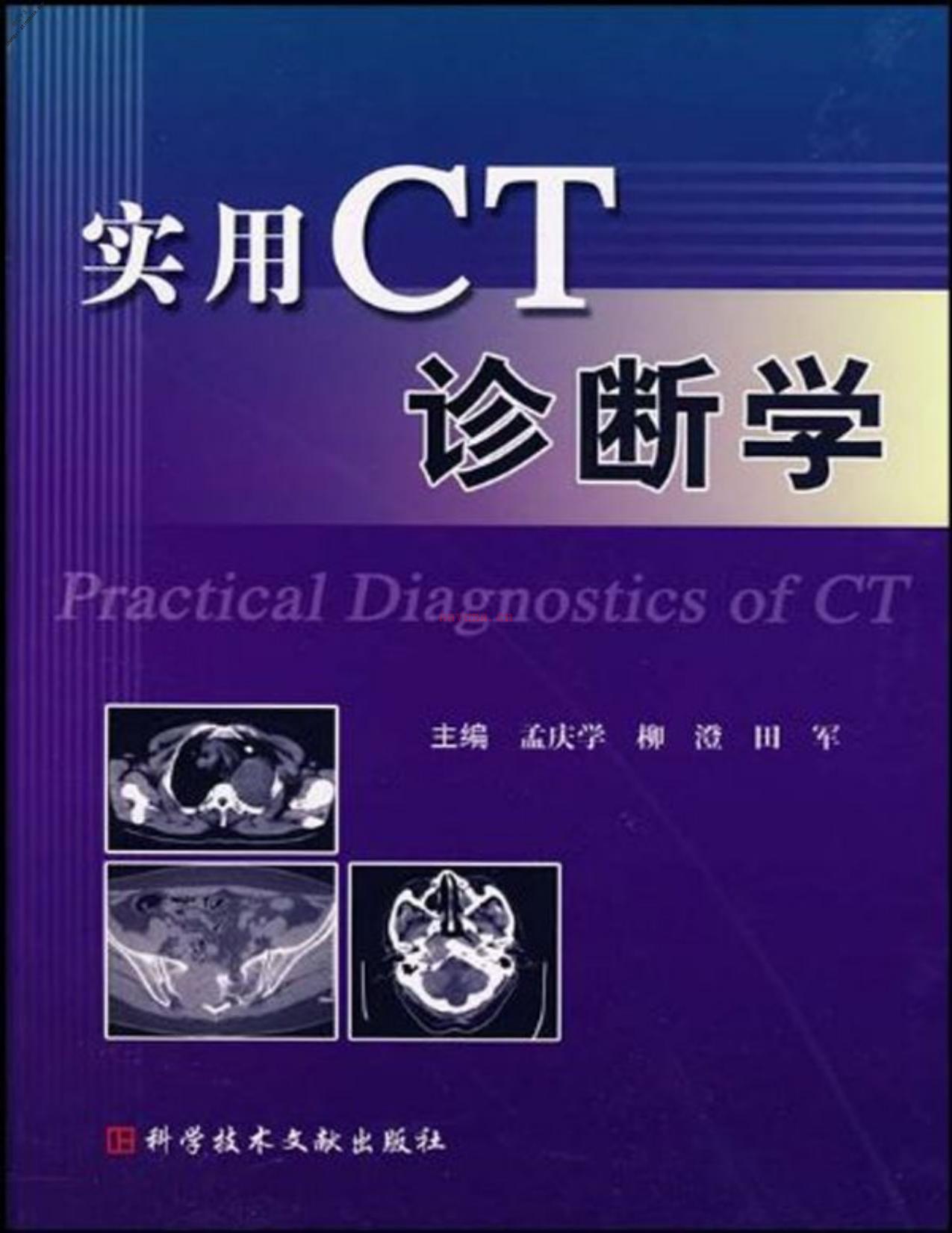 实用CT诊断学-孟庆学 PDF电子版下载