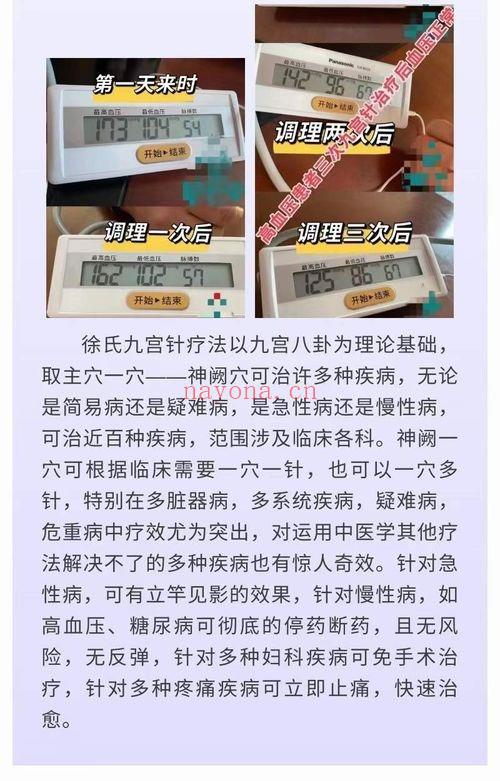 徐熠筱 九宫针疗法临床技术 4集视频