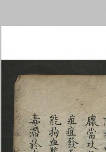 王维德 罗湖 外科证治全生集 , 1886