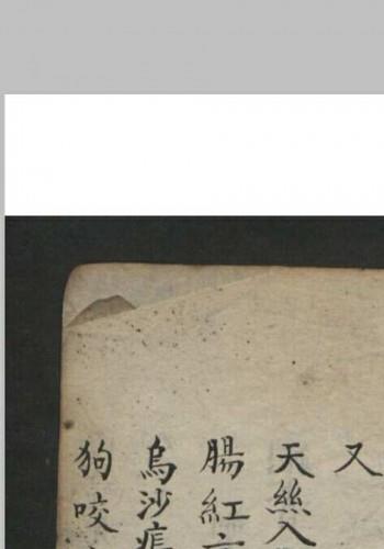 王维德 罗湖 外科证治全生集 , 1886