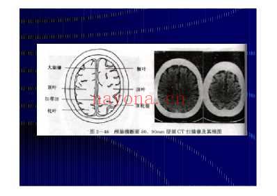 颅脑CT-MRI.pdf