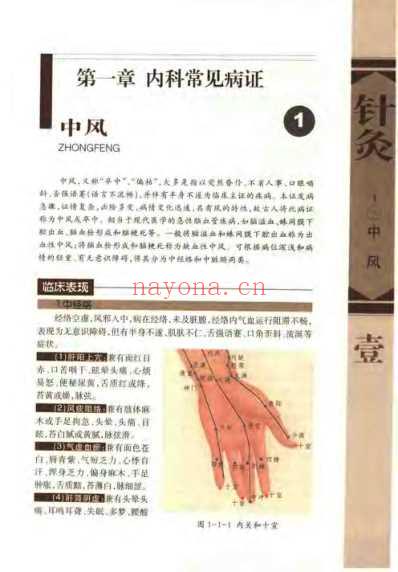 针灸治疗常见病证图解_内科分册_张建华.pdf