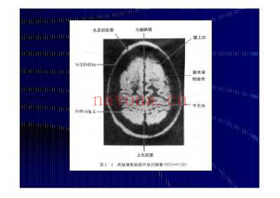 颅脑CT-MRI.pdf