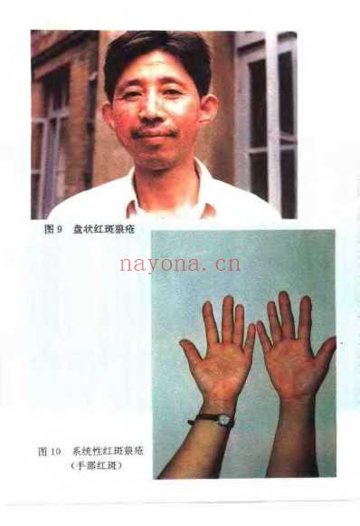 皮肤性病中医治疗全书.pdf