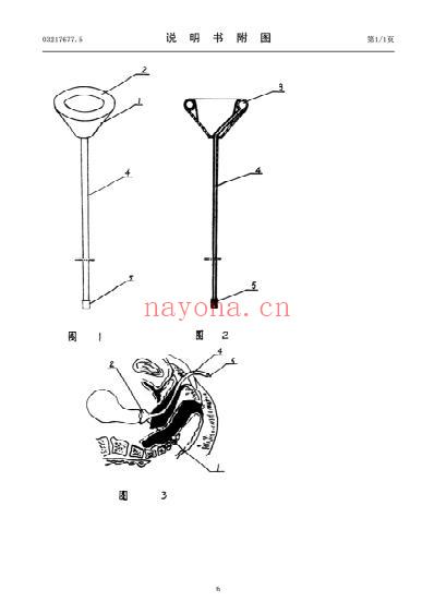 滞留式宫颈炎治疗托.pdf