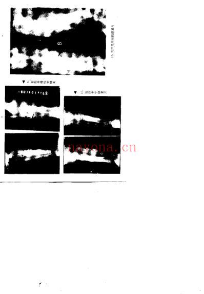 中医骨病证治_夏大中.pdf