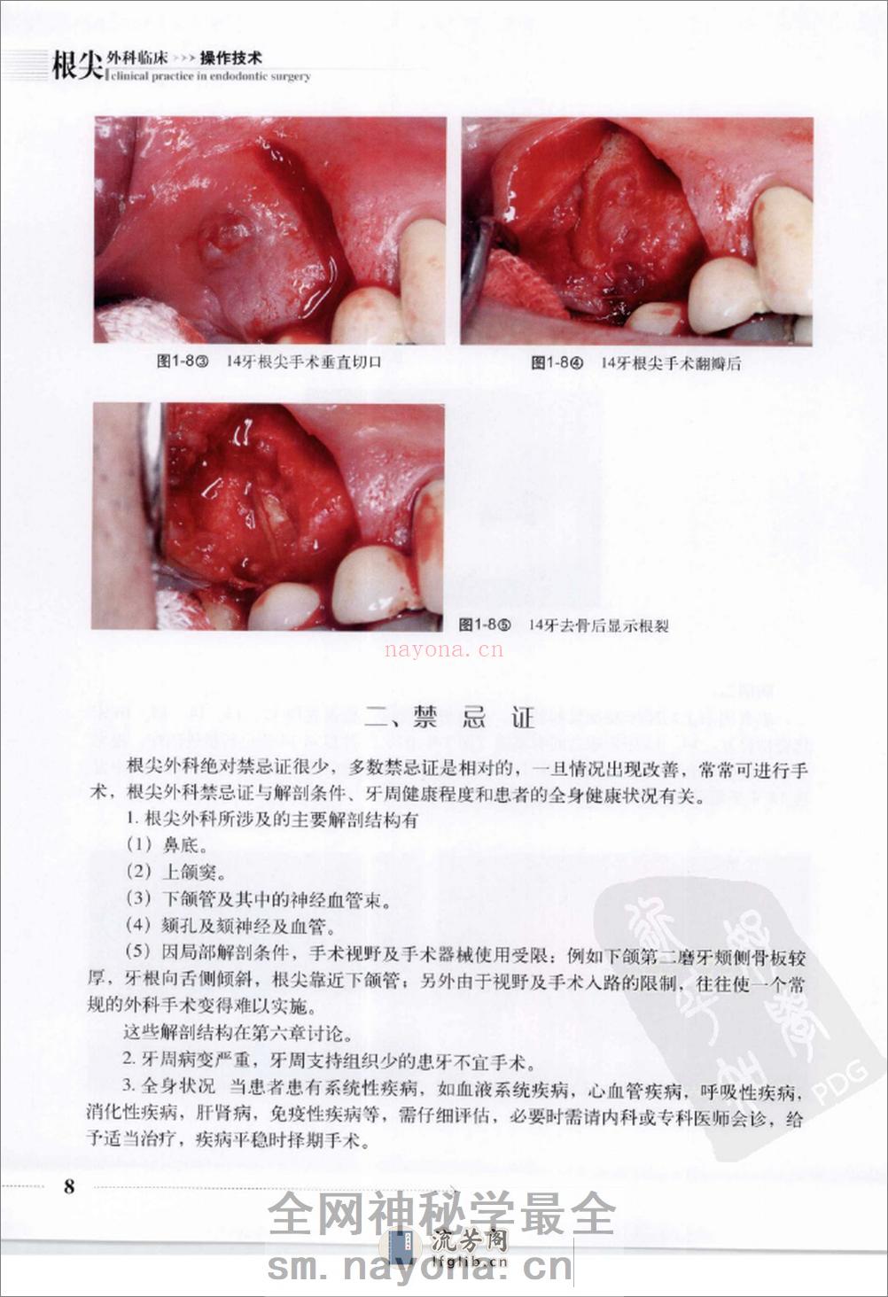 根尖外科临床操作技术_12625986 - 第16页预览图