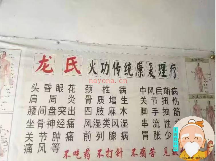 龙氏祖传三代民间火灸疗法