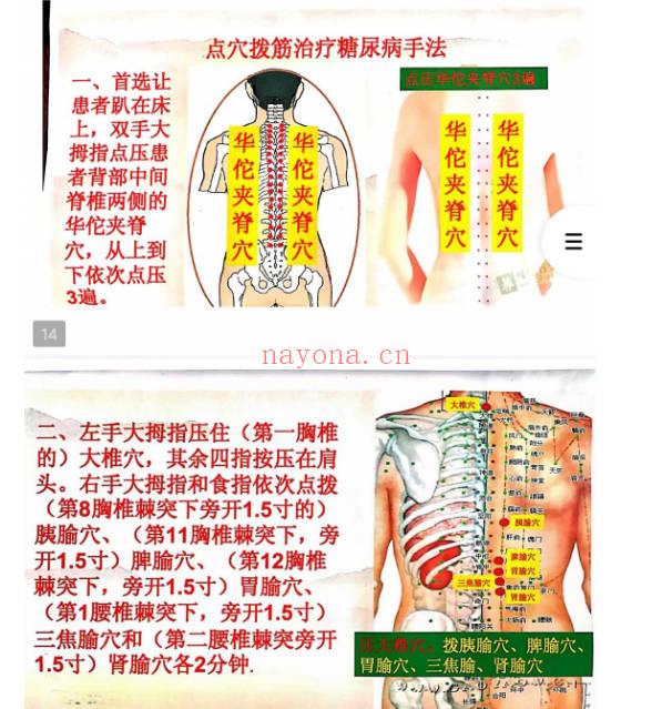 点穴根治糖尿病培训班教材