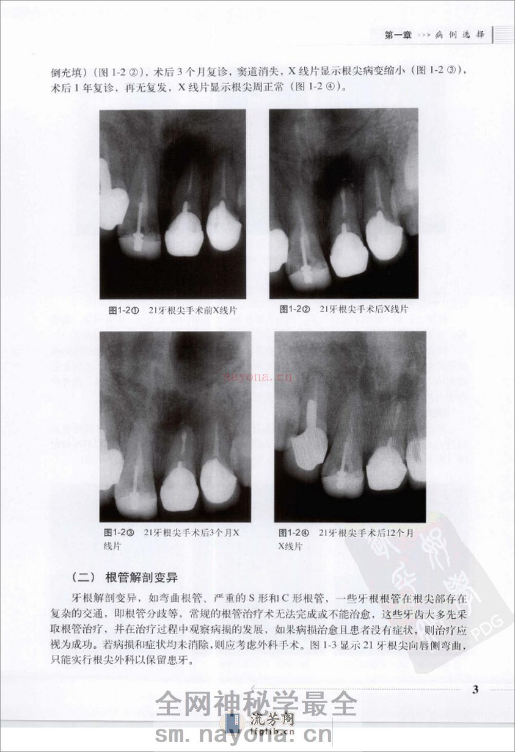 根尖外科临床操作技术_12625986 - 第11页预览图