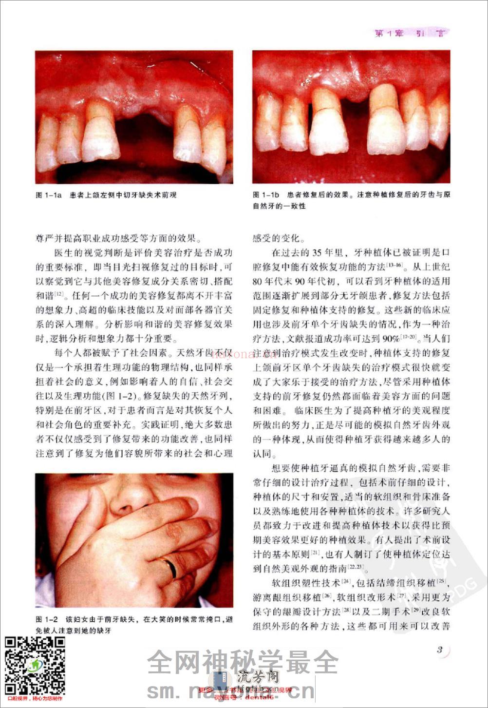 现代手术技巧图谱 种植美容修复术 - 第13页预览图