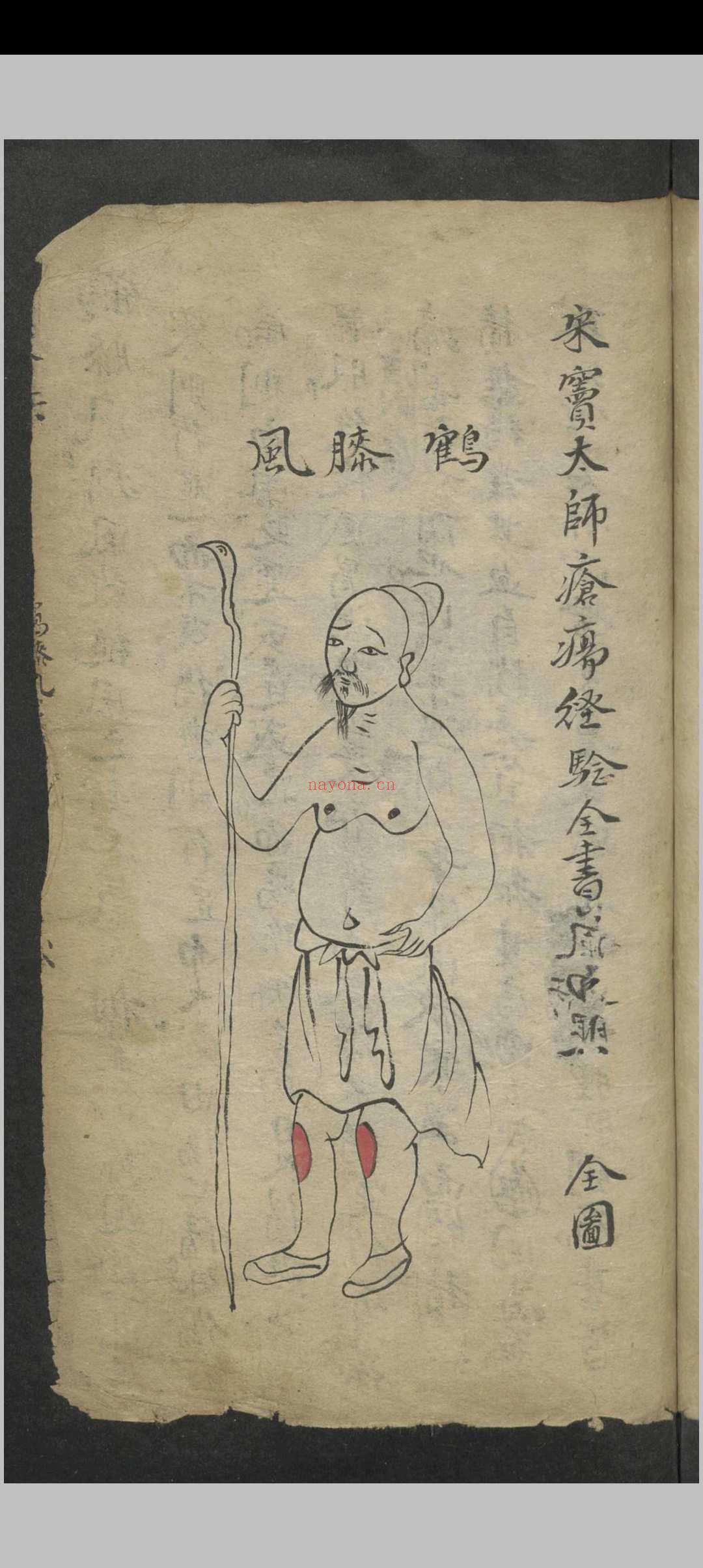 窦杰 窦杰 窦太师疮疡经验全书