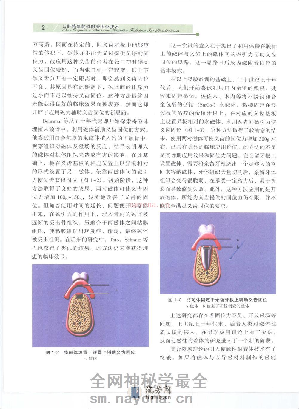 口腔修复的磁附着固位技术 - 第16页预览图