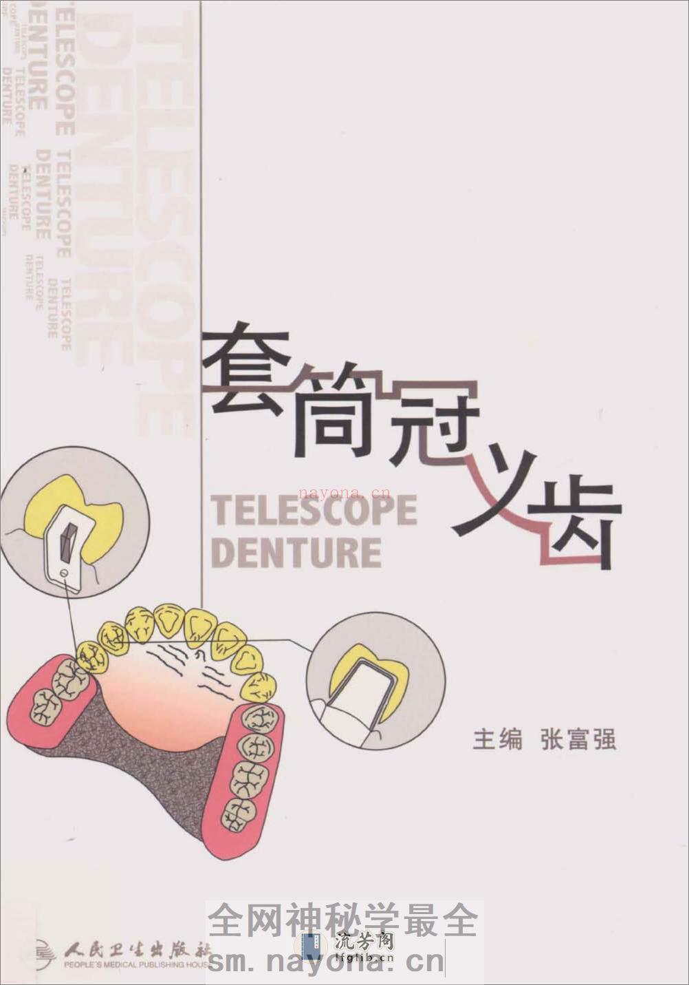 套筒冠义齿 - 第1页预览图