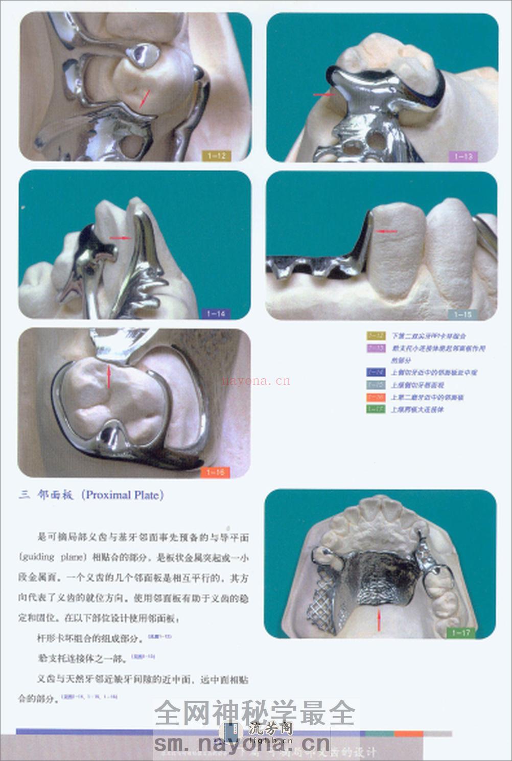可摘义齿 - 第5页预览图