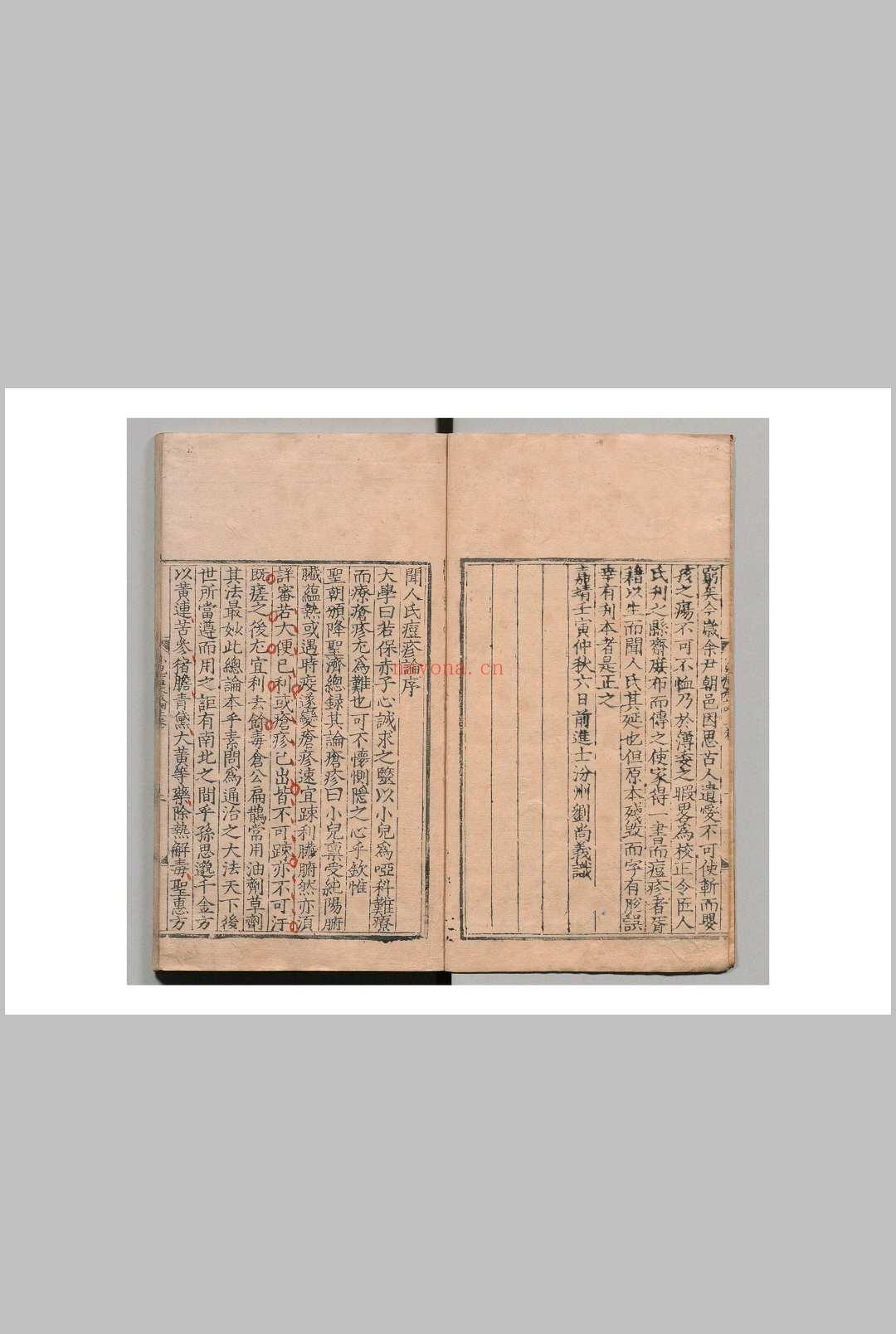 闻人氏痘疹论 闻人规(元)刘尚义(明) 李倬(明) 明嘉靖37年