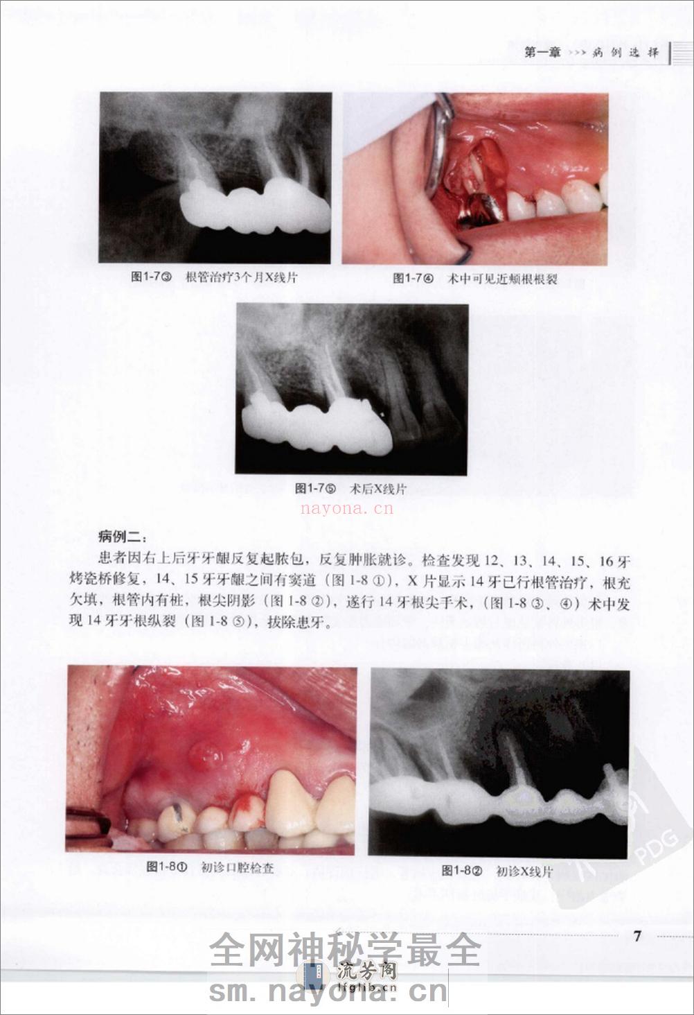 根尖外科临床操作技术_12625986 - 第15页预览图