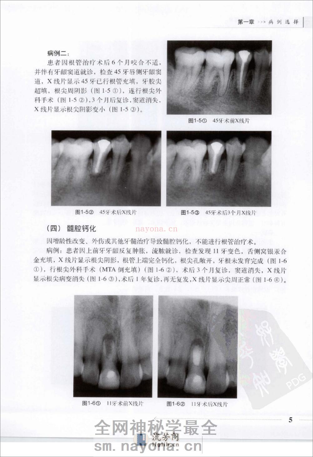 根尖外科临床操作技术_12625986 - 第13页预览图