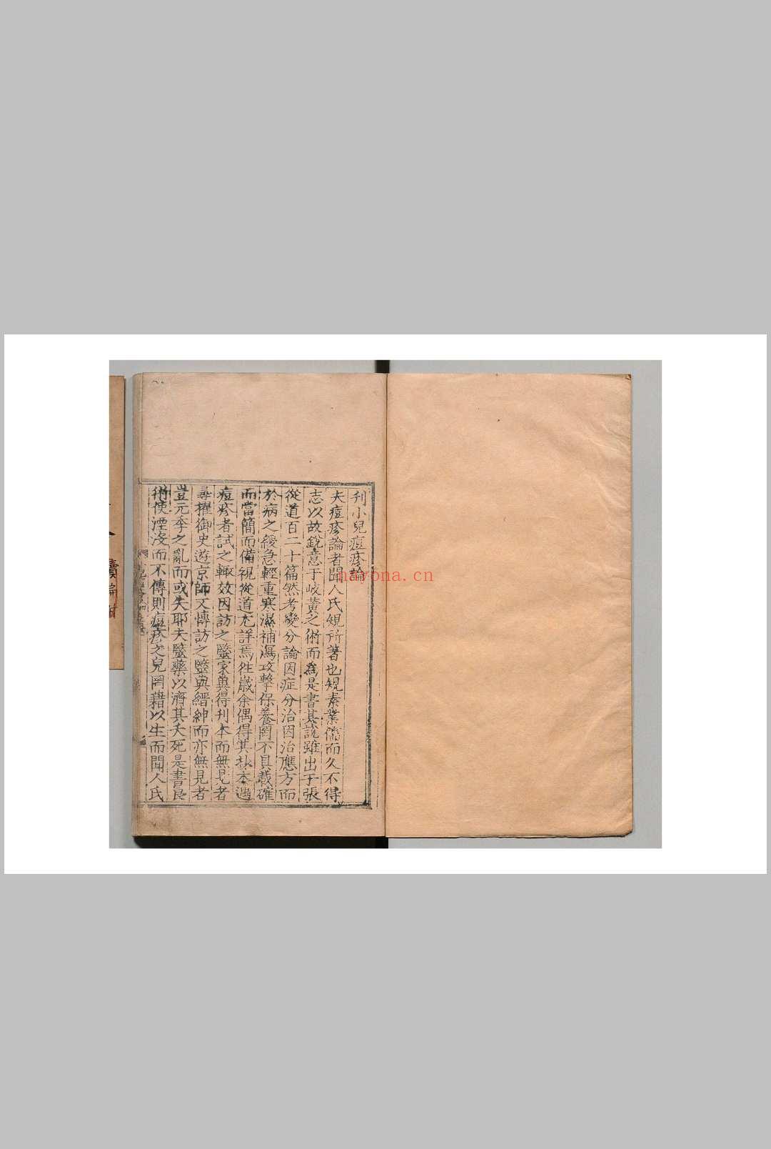 闻人氏痘疹论 闻人规(元)刘尚义(明) 李倬(明) 明嘉靖37年