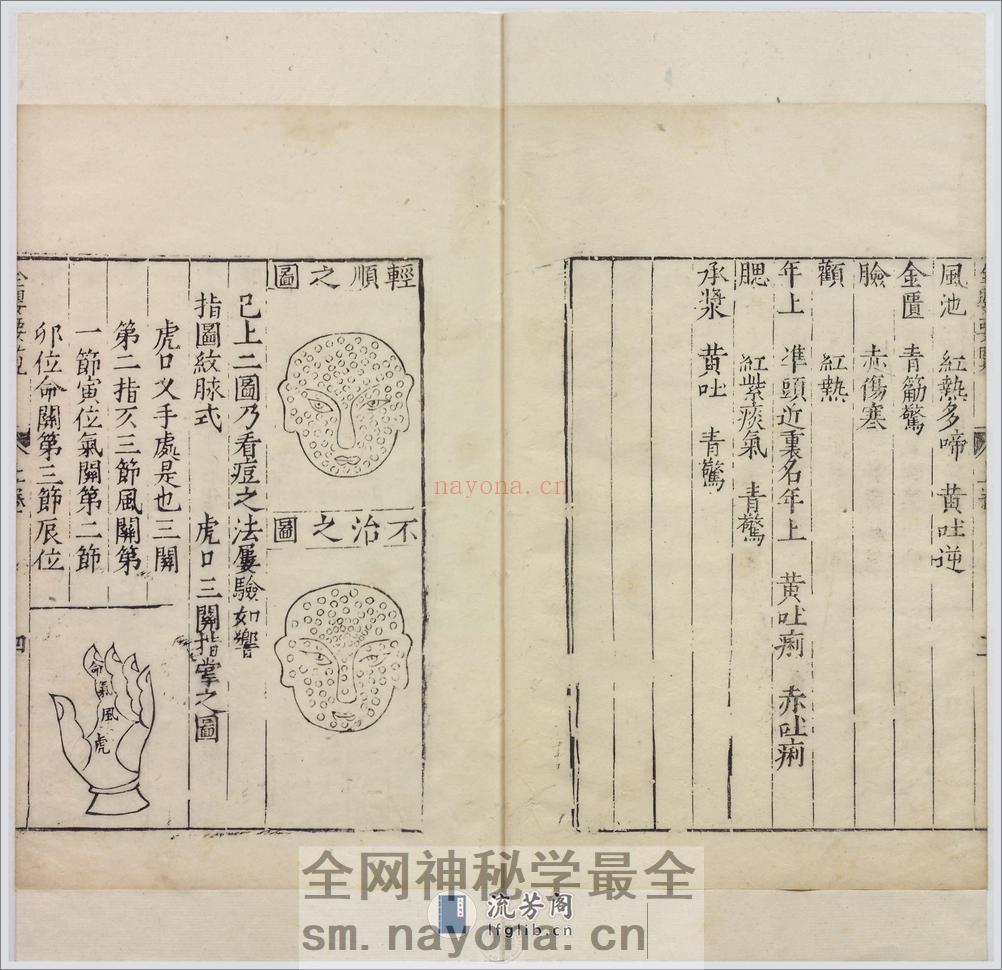全婴要览.2卷.明闵道扬撰.明隆庆6年金陵刊本.1572年 - 第10页预览图