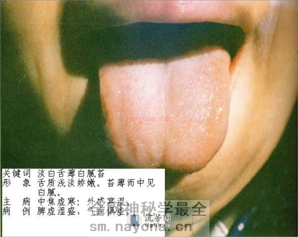 舌诊图片 - 第18页预览图
