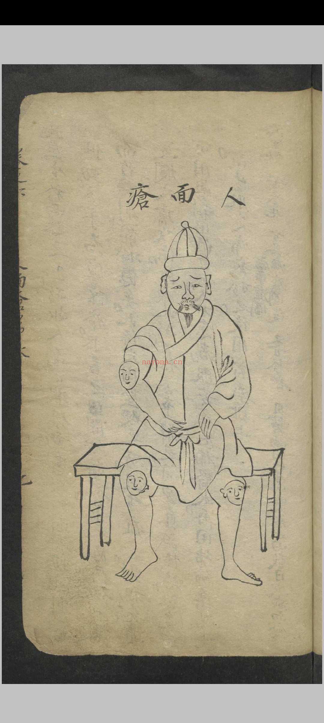 窦杰 窦杰 窦太师疮疡经验全书