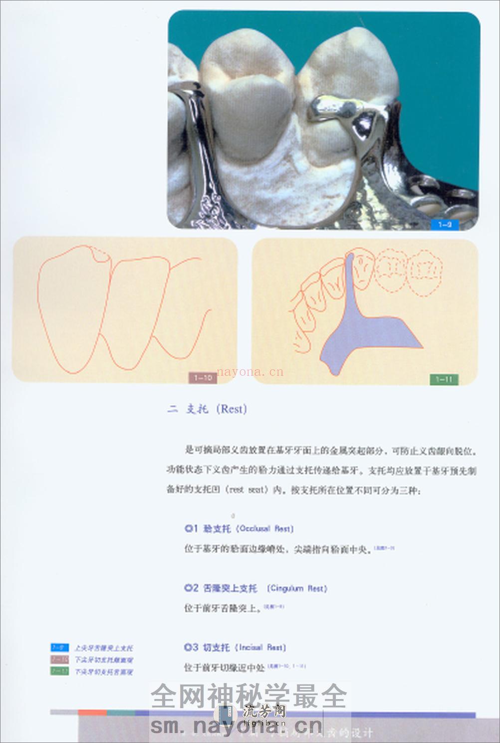可摘义齿 - 第4页预览图