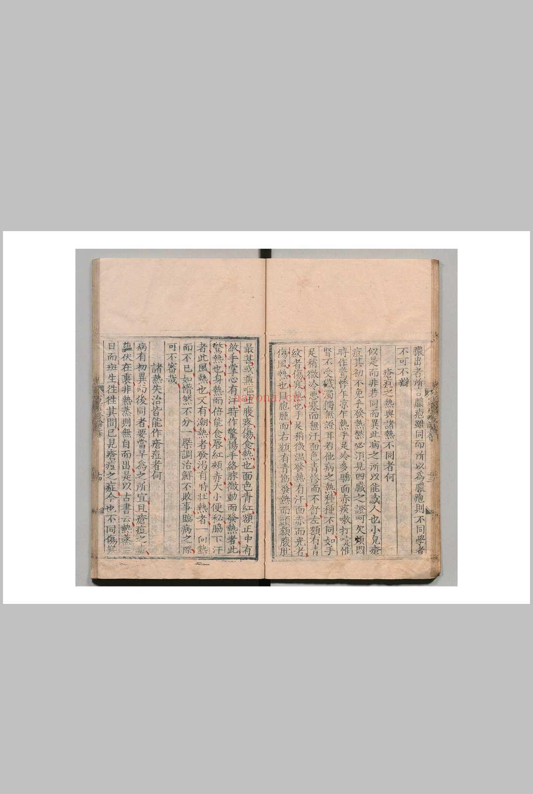 闻人氏痘疹论 闻人规(元)刘尚义(明) 李倬(明) 明嘉靖37年
