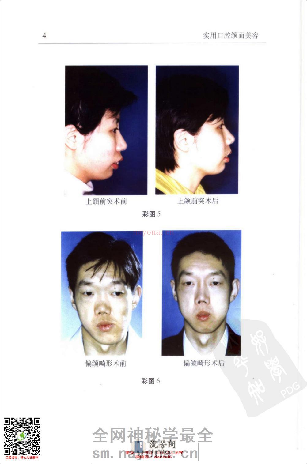 实用口腔颌面美容_11576035 - 第13页预览图