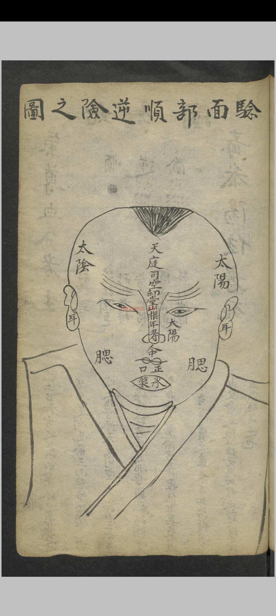 窦杰 窦杰 窦太师疮疡经验全书