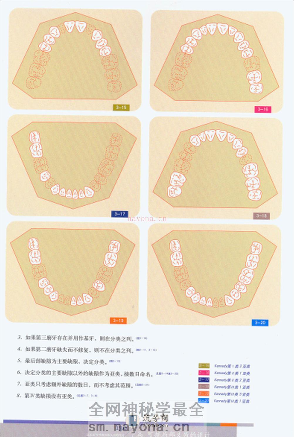 可摘义齿 - 第19页预览图