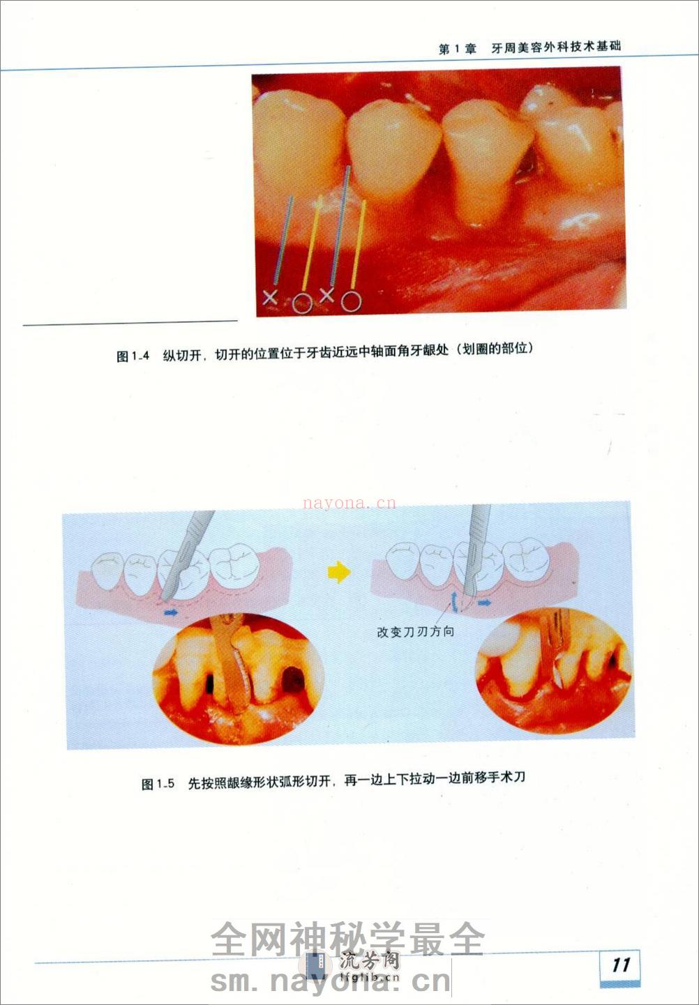 图解牙周美容外科实用技术 - 第18页预览图